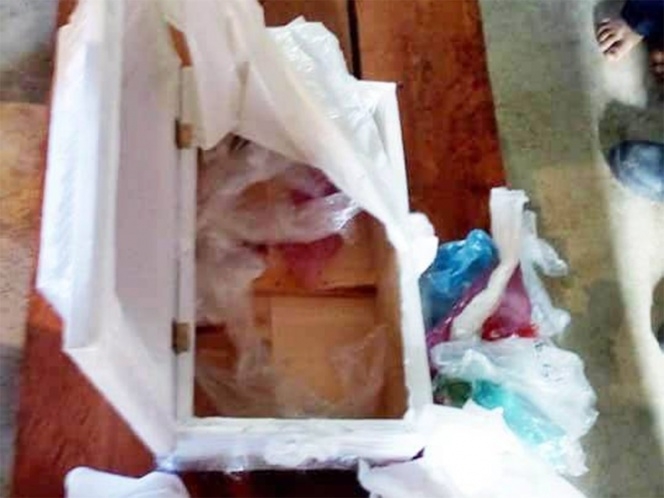Va a hospital por el cuerpo de su bebé y le dan ataúd con basura