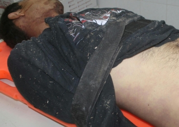 Detenido por posible  asesinato de su primo