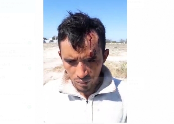 Desconocidos levantan a hondureño y lo lesionan a golpes