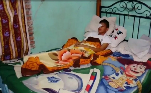 Estudiante de secundaria, víctima de bullying, podría quedar ciego tras golpes de compañeros