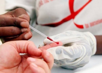 Hasta tres mil casos nuevos de VIH al año registra el IMSS