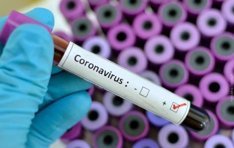 Sin indicaciones salud municipal por coronavirus