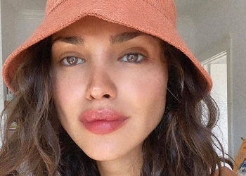 Eiza González se hace nuevo retoque al rostro