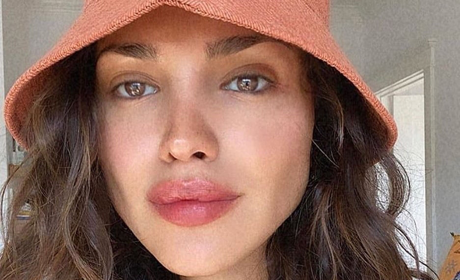 Eiza González se hace nuevo retoque al rostro