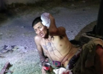 Agreden a joven con un tubo
