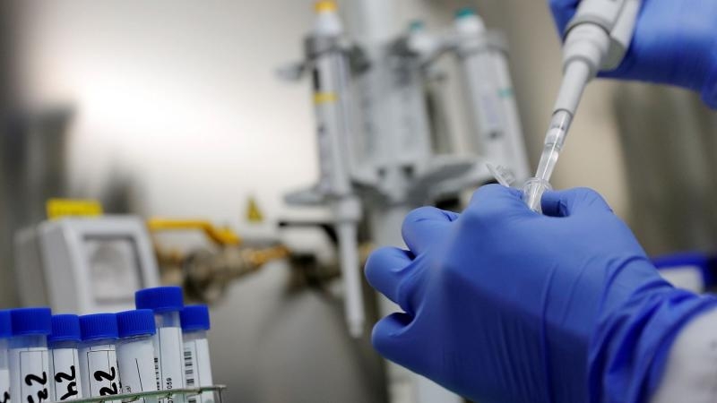 OMS reacciona con cautela a vacuna rusa contra COVID-19