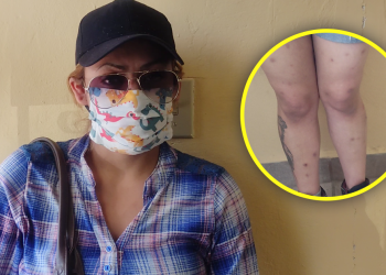 Joven madre pide ayuda; presenta grave problema de salud