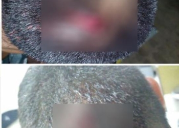 Sin denuncia tres casos de leiones