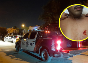 Lesionado por arma blanca tiene un pulmón perforado
