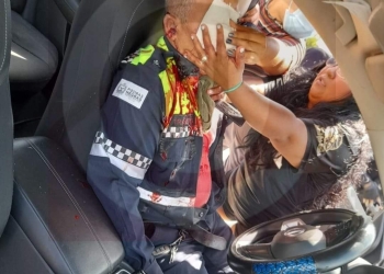 Grave policía municipal que recibió dos balazos