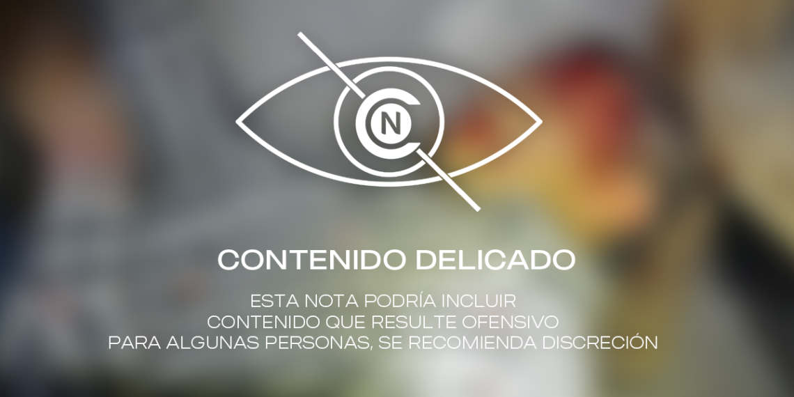 Vinculado a proceso responsable de lesiones graves