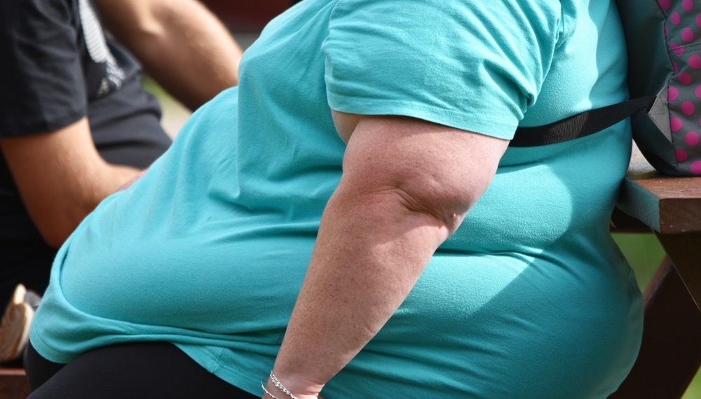 Celebrarán con activación física el Día Mundial contra la Obesidad