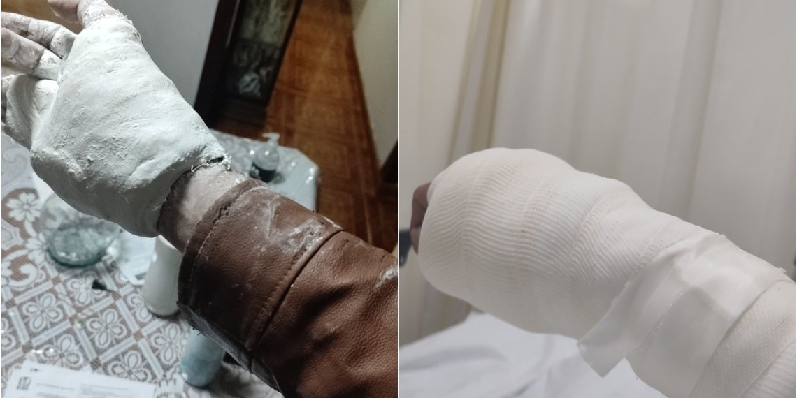 Ponen yeso a paciente en el IMSS y no se puede quitar su chamarra