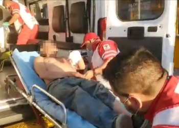 Provoca incendio con cigarro y sufre quemaduras en el brazo