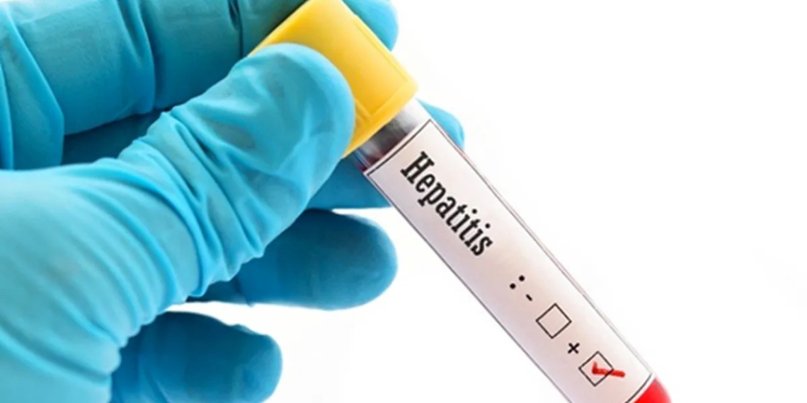 Confirma Nuevo León cuatro casos de hepatitis en menores
