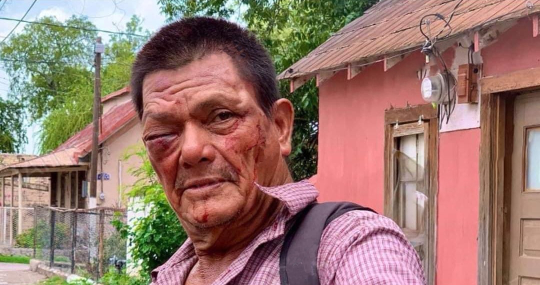 Ladrón se hace pasar por víctima para evitar ser detenido