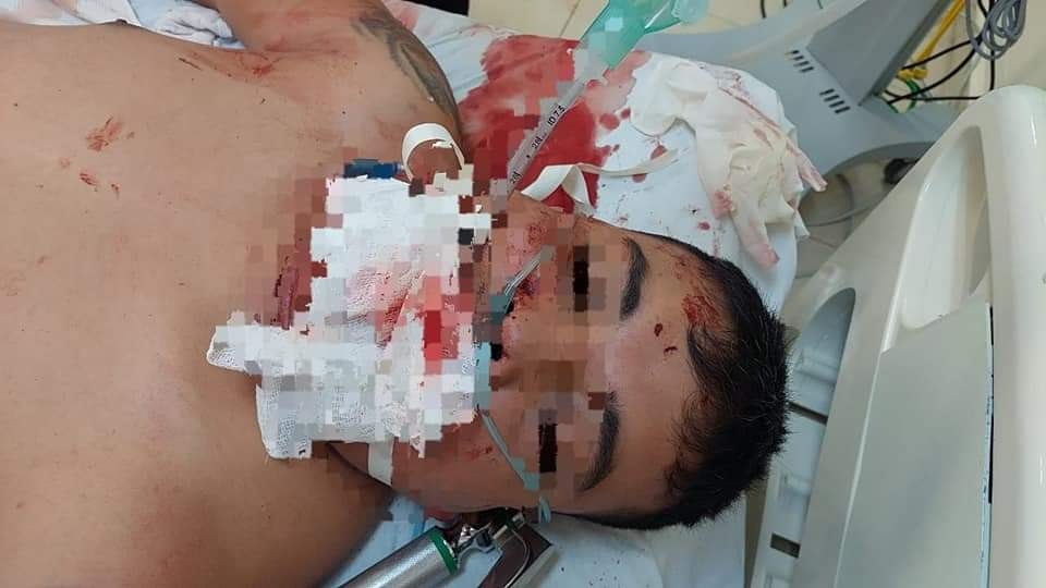 Realizan reconstrucción facial a motociclista lesionado