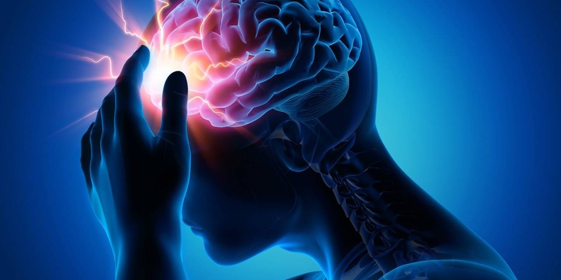 Alarmante aumento de casos de infarto cerebral en México